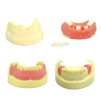 Модель для практики имплантации зубов, съемный инструмент для обучения стоматолога четырех типов