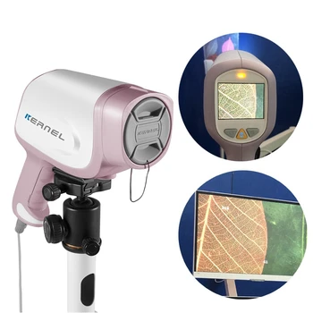 KN- 2200I 2-экранный 30-кратный оптический зум-гинекологический кольпоскопический аппарат для исследования желтой матки и снижения остроты зрения